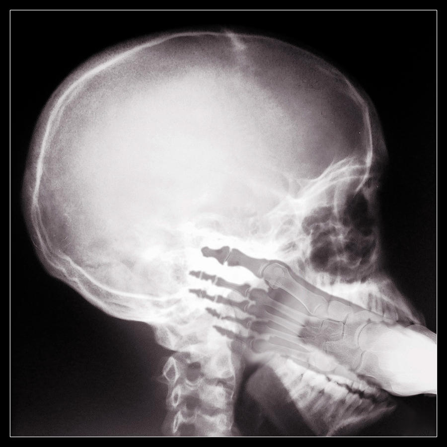 Xray Picture Of Cock In Mouth 75